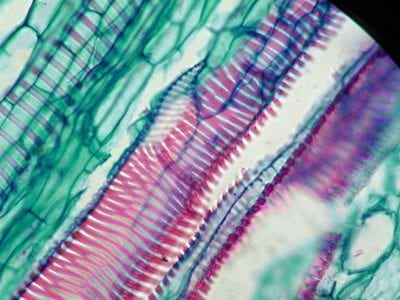 Xilema observado al microscopio en un tallo de Cucurbita maxima